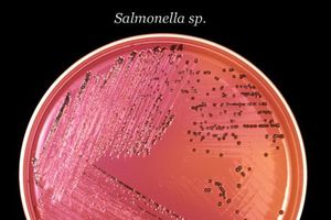 OBOLELO 19 DECE: Epidemija salmonele u čačanskim vrtićima